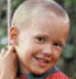 hearing loss in children